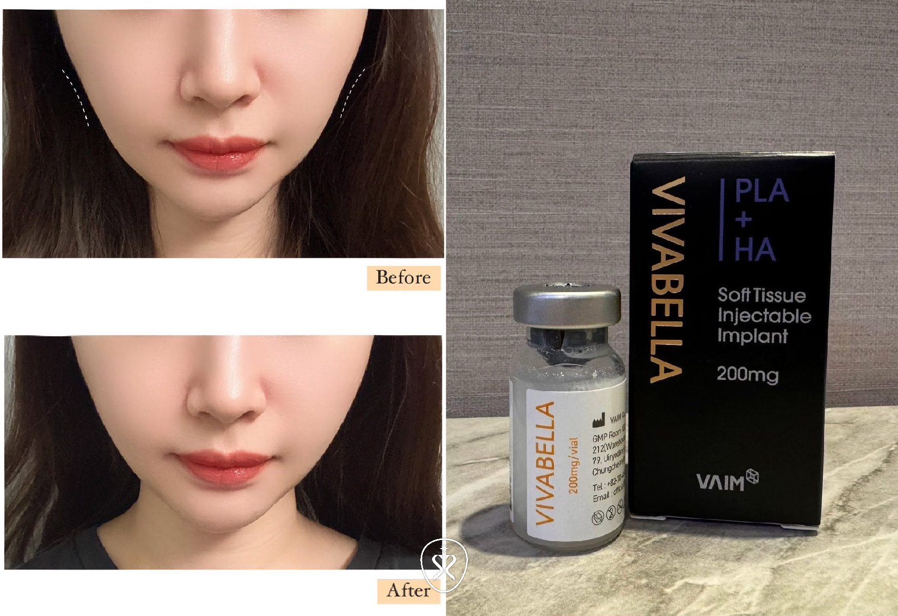 薇貝拉(魔法針)刺激膠原蛋白增生，恢復飽滿彈潤